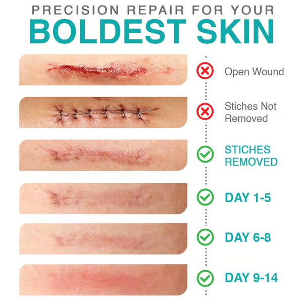 CareBreeze® 3-in-1 Scar Removal Microneedle Care Patch
