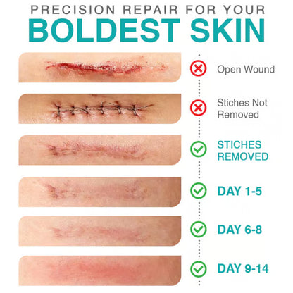 CareBreeze® 3-in-1 Scar Removal Microneedle Care Patch