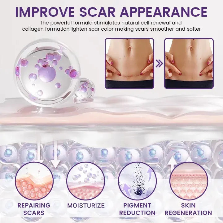 🔥Nuvelliana™: Flatten, Fade, and Improve Your Scars in 14 Days🔥