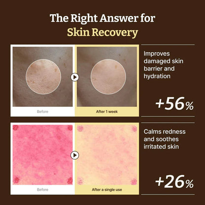 Advanced PDRN Rejuvenating Cream (Secret Deal)