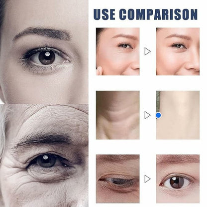 🏆Flash Sale⚡2026 NEW Micro-Molecular Collagen Anti-Wrinkle Lotion