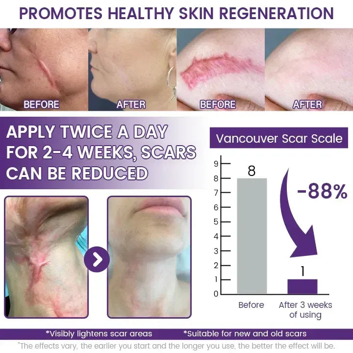 🔥Nuvelliana™: Flatten, Fade, and Improve Your Scars in 14 Days🔥