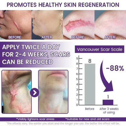 🔥Nuvelliana™: Flatten, Fade, and Improve Your Scars in 14 Days🔥