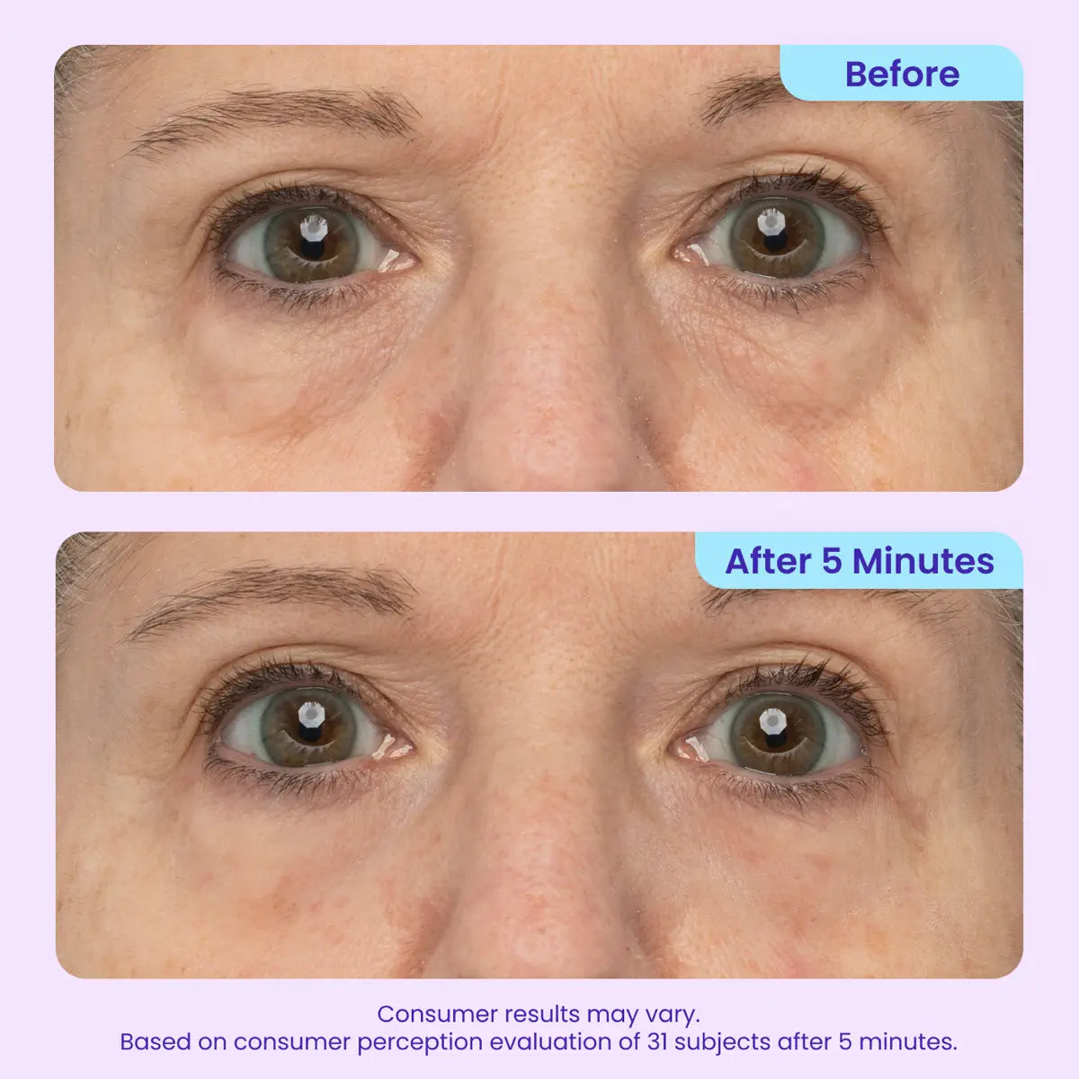 ✨Instant lifting eye gel helps you regain your youthful appearance