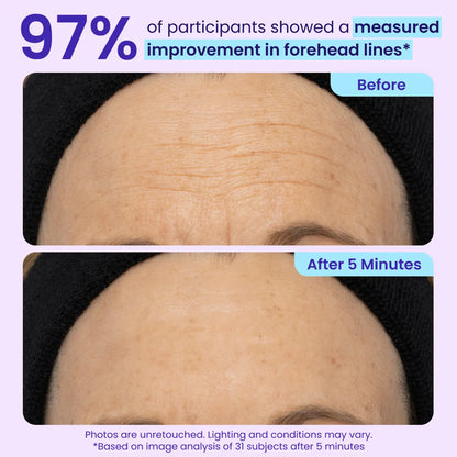 ✨Instant lifting eye gel helps you regain your youthful appearance