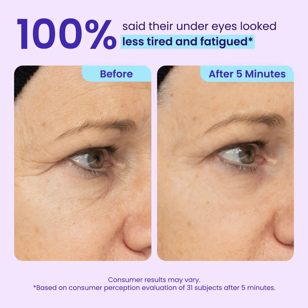 ✨Instant lifting eye gel helps you regain your youthful appearance