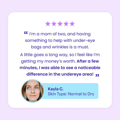 ✨Instant lifting eye gel helps you regain your youthful appearance