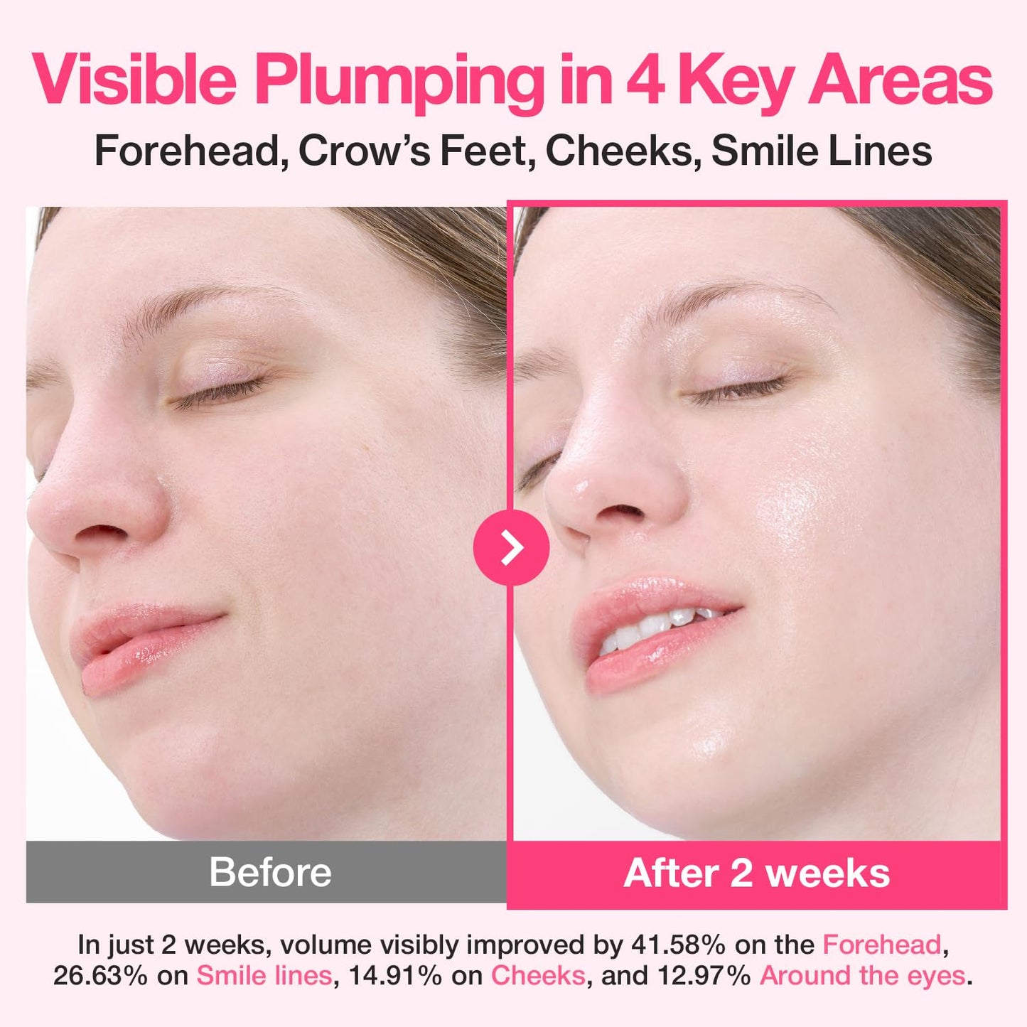 numbuzin No.2 Rose PDRN Collagen Plumping Serum, Hydrating & Firming Serum with Peptides, Plump, Glowing Skin,