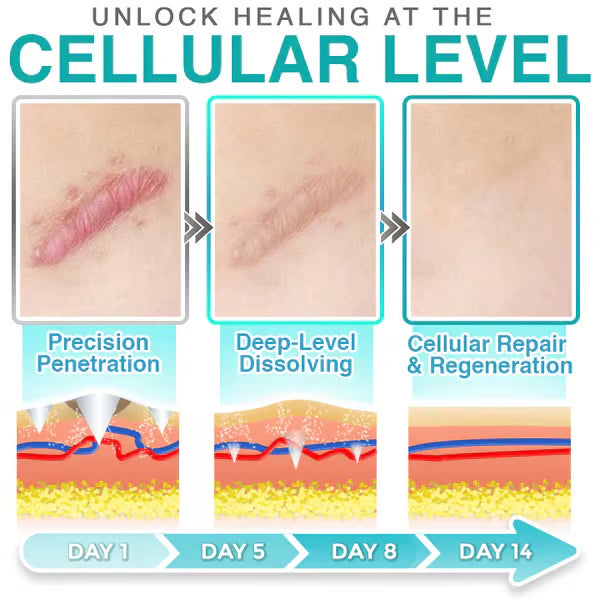 CareBreeze® 3-in-1 Scar Removal Microneedle Care Patch
