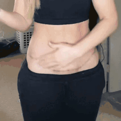 🔥Nuvelliana™: Flatten, Fade, and Improve Your Scars in 14 Days🔥