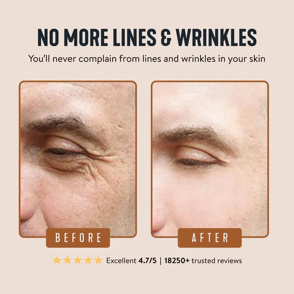 🔥Limited Time Offer 🔥Wrinkle Defense Tallow Balm