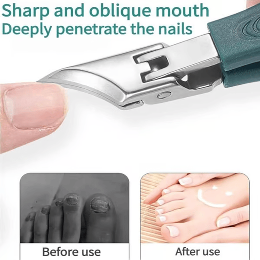 Nail clippers recommended👨‍⚕️ by podiatrists